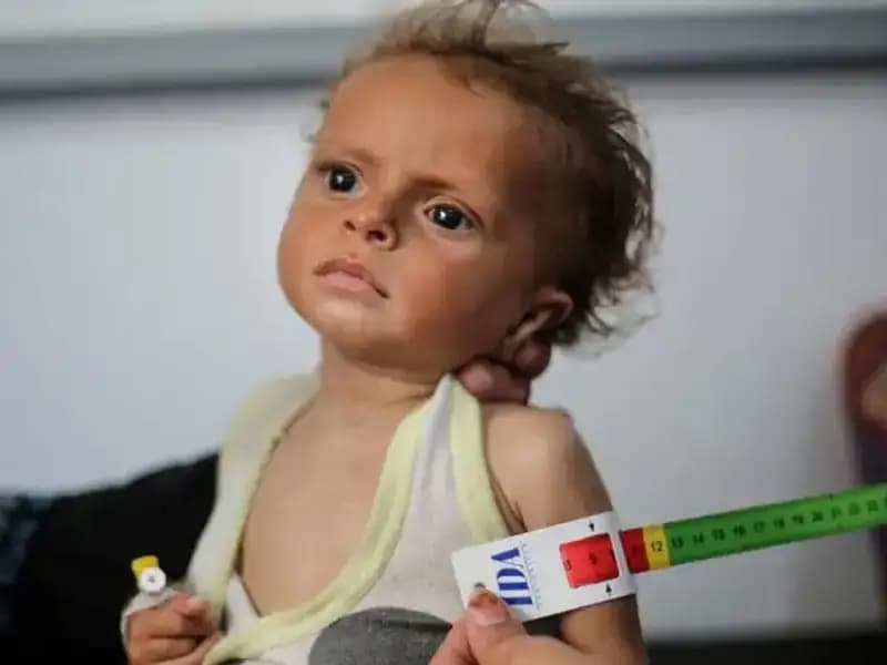 İngiltere, 300 Gazze'li Çocuğa Umut Olacak Bir İnisiyatif Başlattı