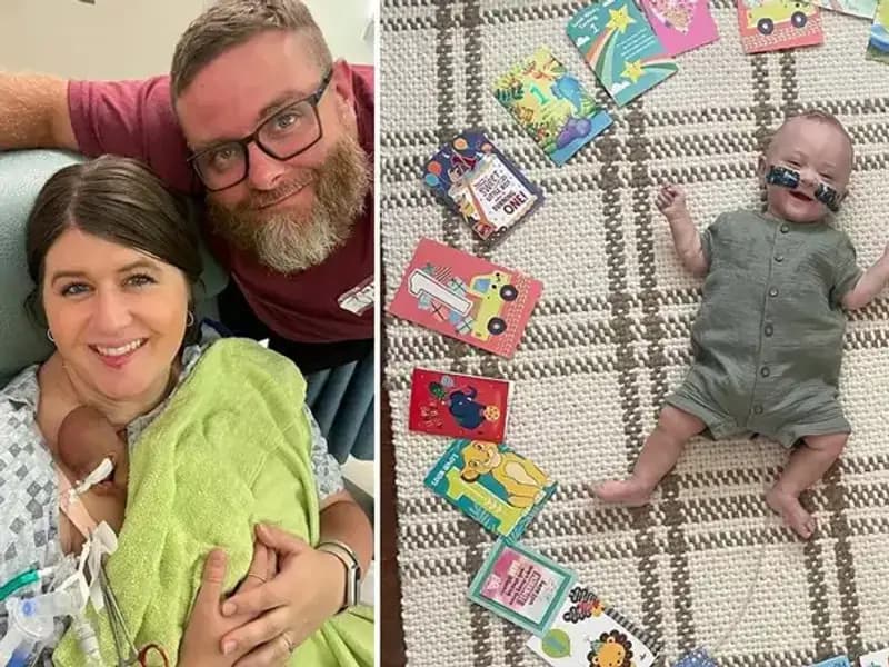 280 Gramla Hayata Merhaba Diyan Dünyanın En Prematüre Bebeği