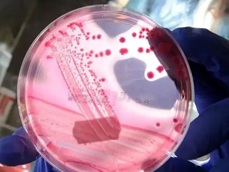 Yaşlanmayı Unutturan Keşif: AP2A1 Proteini ve Etkileri