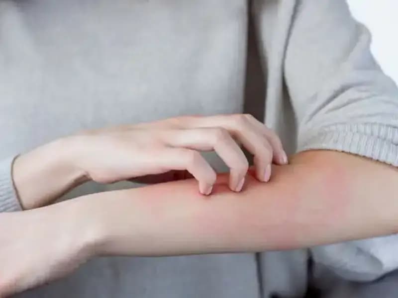 Cilt Kanserinin Gizli Belirtileri: Dermatologlardan Önemli Uyarılar