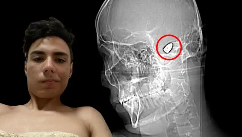 Kafasında Patlayıcı Var: Psikolojik Sorunları ile Savaşan Bir Genç
