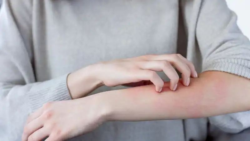 Cilt Kanserinin Gizli Belirtileri: Dermatologlardan Önemli Uyarılar